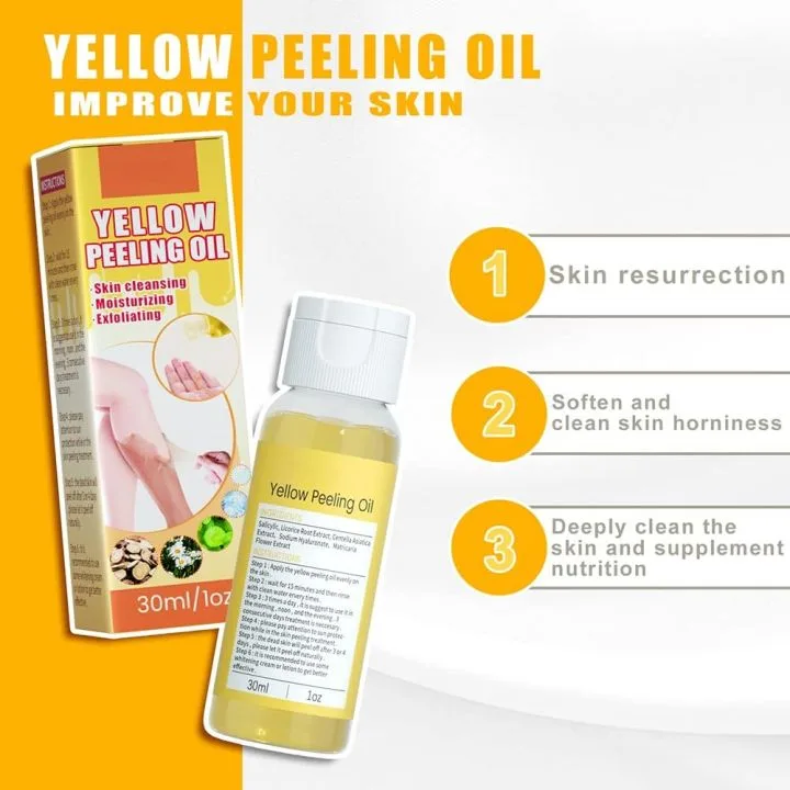 Homtopy Extra Strength Yellow Peeling Oil angle 2